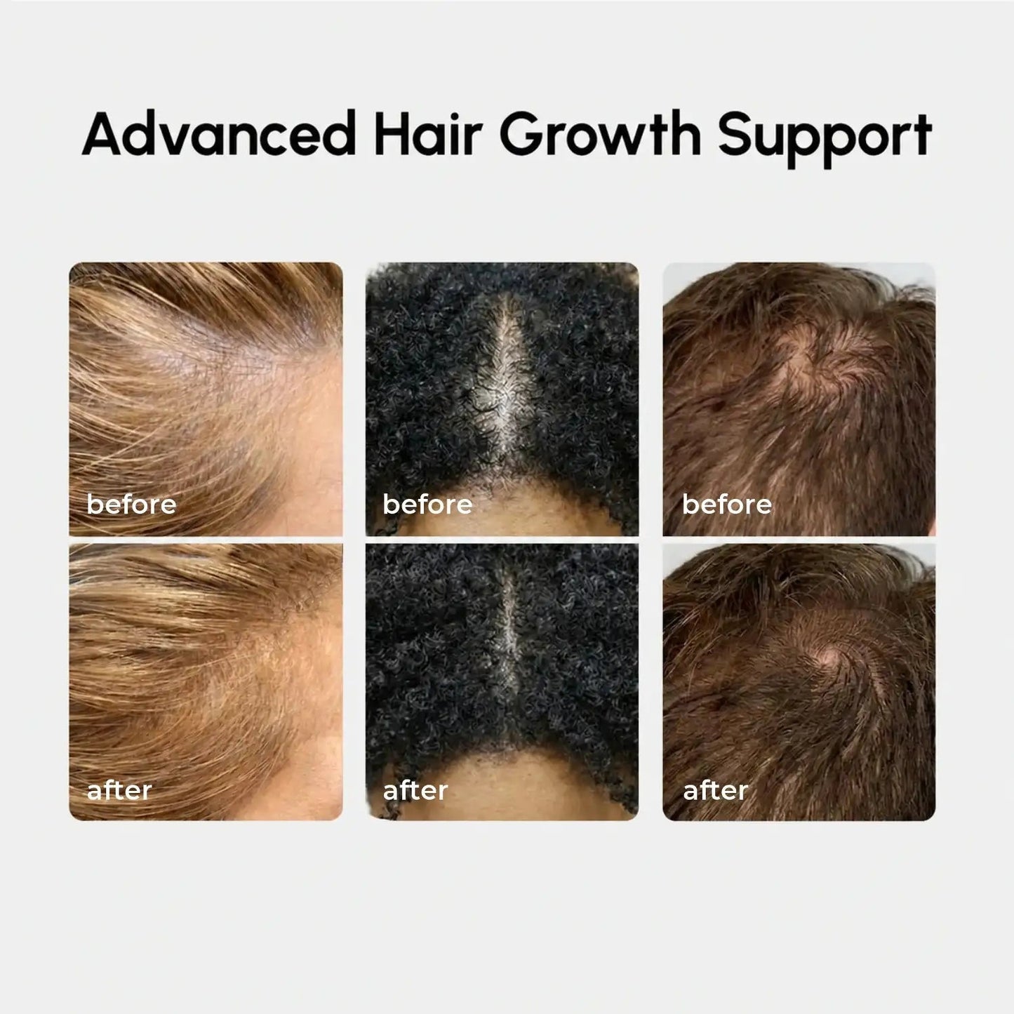 4-in-1 Hair Growth Spray - My Store 3