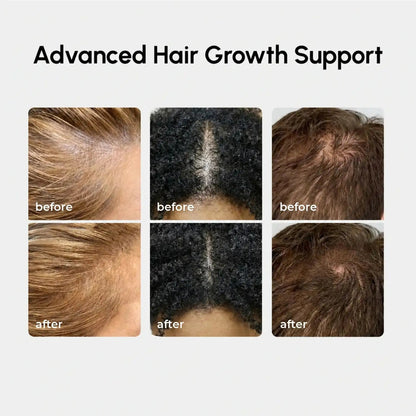 4-in-1 Hair Growth Spray - My Store 3