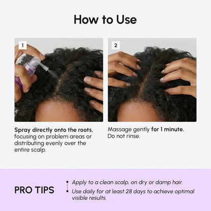 4-in-1 Hair Growth Spray - My Store 3