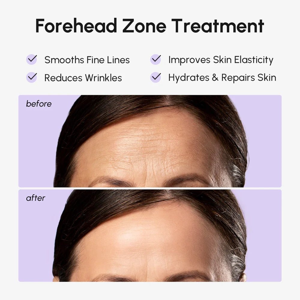 Anti-Wrinkle Forehead Patches - My Store 3