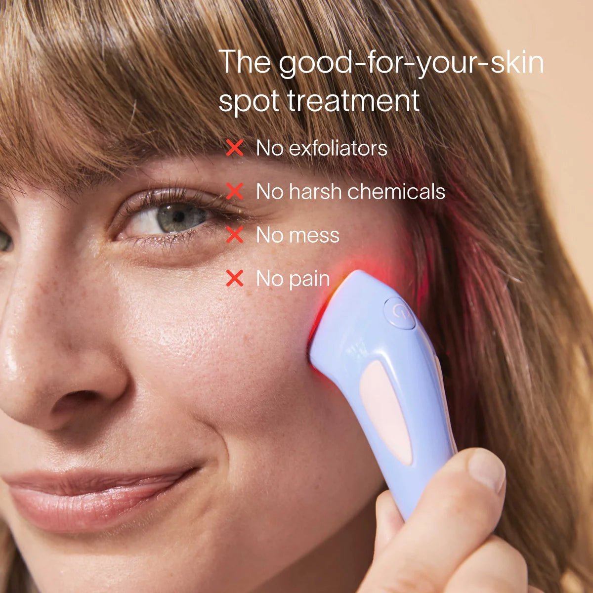 Bye Acne: 3-Minute Pimple Spot Treatment - My Store 3