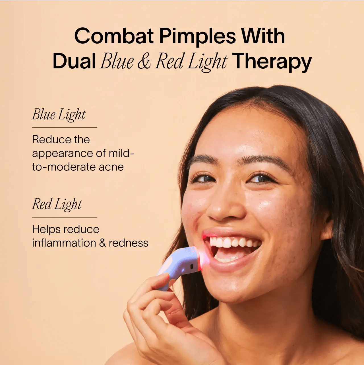 Bye Acne: 3-Minute Pimple Spot Treatment - My Store 3